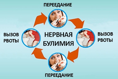 Лечение булимии в Чкаловске
